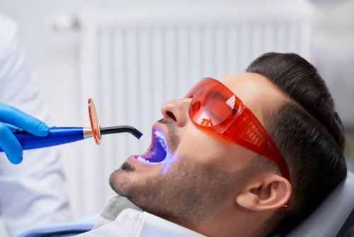 Zahnfüllungen - Zahnarzt Ordination Dr. Erika Devenyi