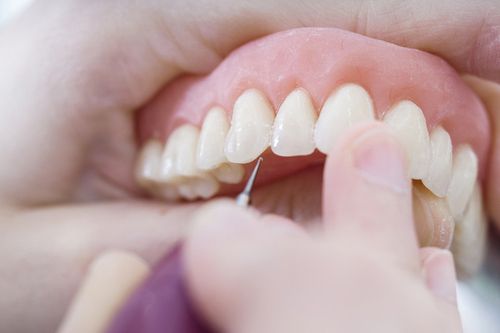 Dr. Erika Devenyi Ihre Zahnärztin in Wien, Unser Schwerpunkt Zahnersatz